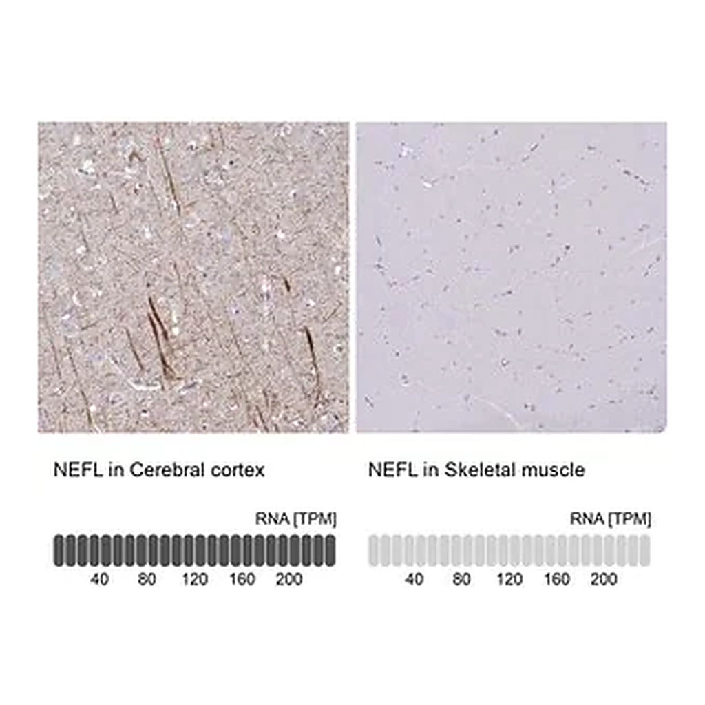 Merck Anti-NEFL antibody produced in rabbit