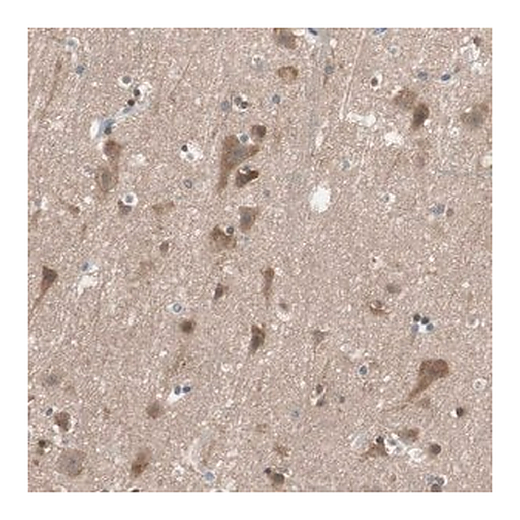 Merck Anti-ADAP1 antibody produced in rabbit