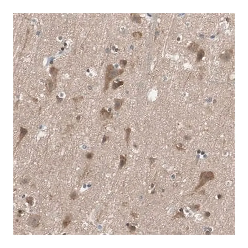 Merck Anti-ADAP1 antibody produced in rabbit