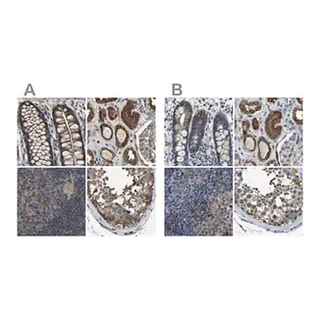 Merck Anti-FHIT antibody produced in rabbit