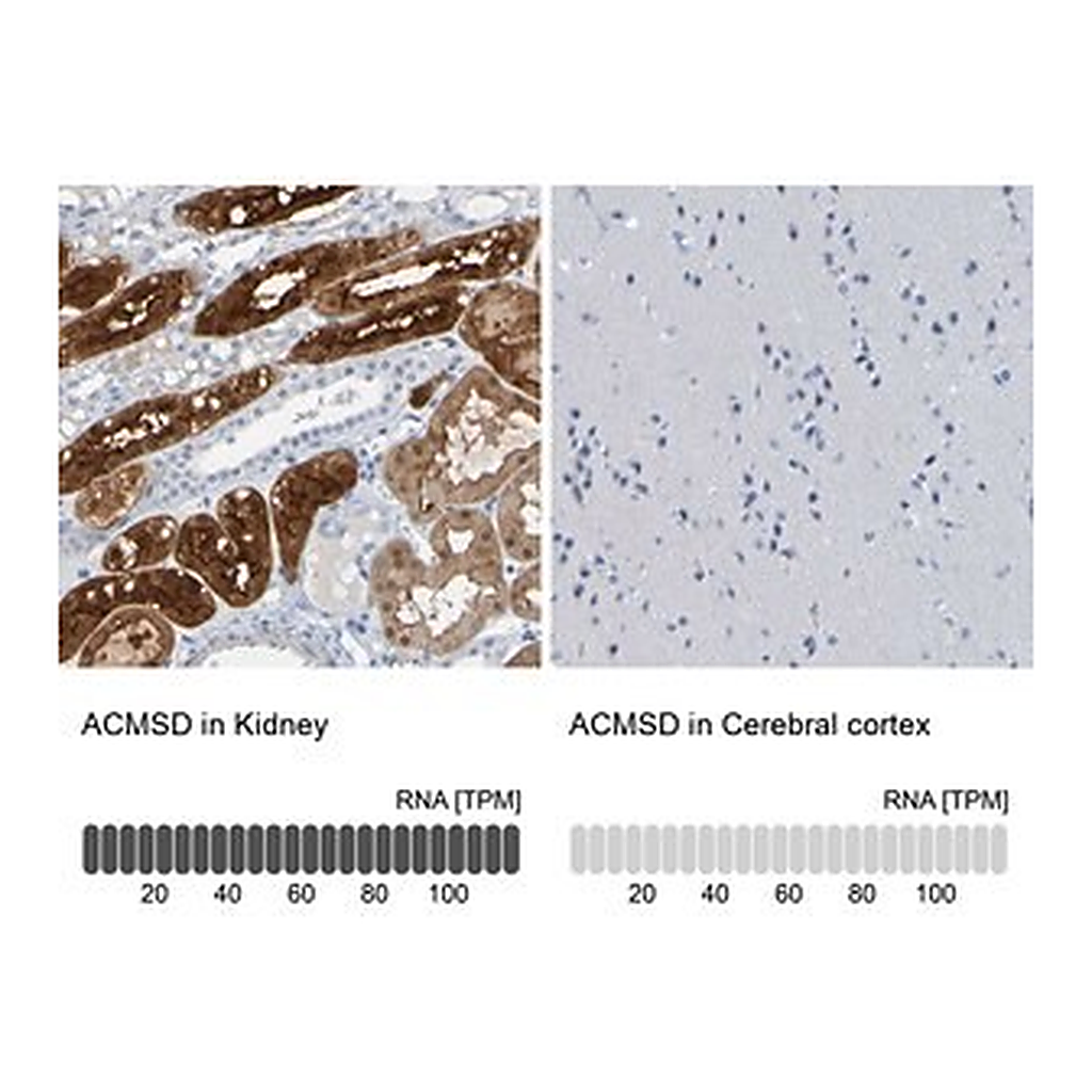 Merck Anti-ACMSD antibody produced in rabbit