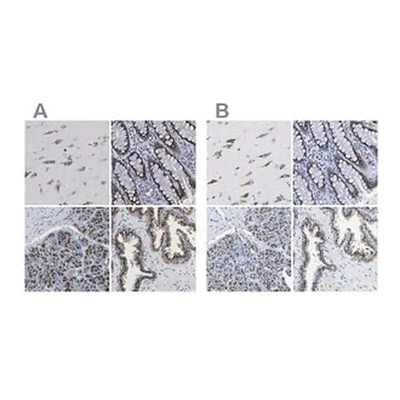 Merck Anti-TMEM87A antibody produced in rabbit