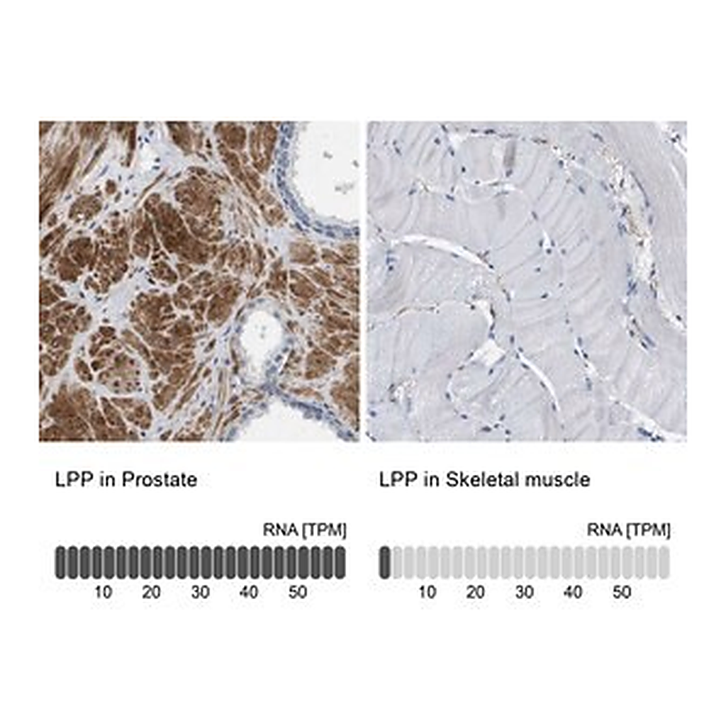 Merck Anti-LPP antibody produced in rabbit