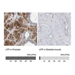 Merck Anti-LPP antibody produced in rabbit