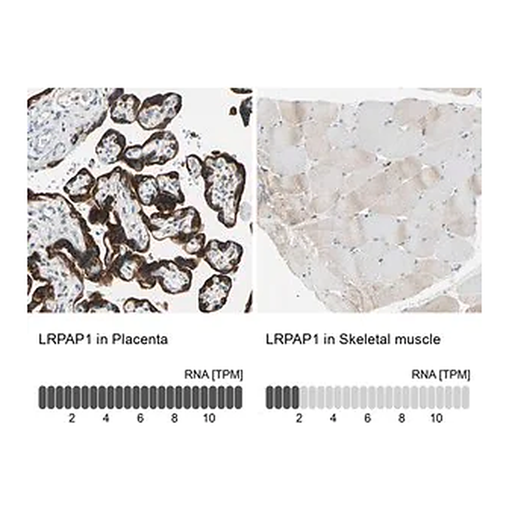 Merck Anti-LRPAP1 antibody produced in rabbit