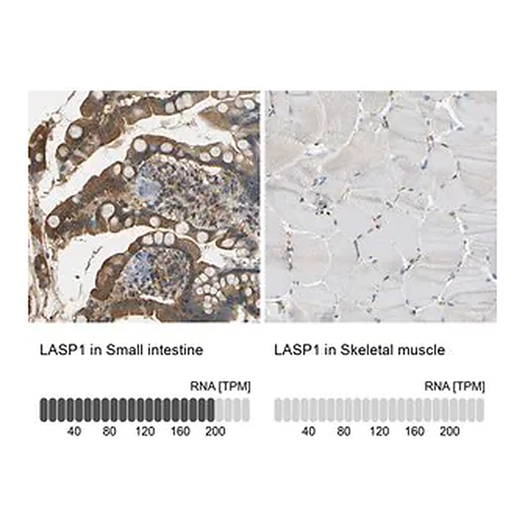 Merck Anti-LASP1 antibody produced in rabbit