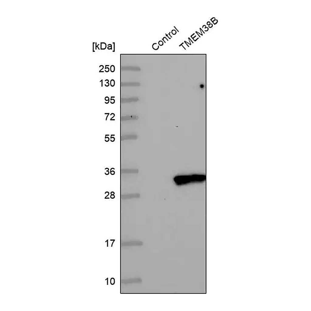 Merck Anti-TMEM38B antibody produced in rabbit