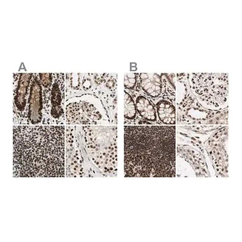 Merck Anti-CHAMP1 antibody produced in rabbit