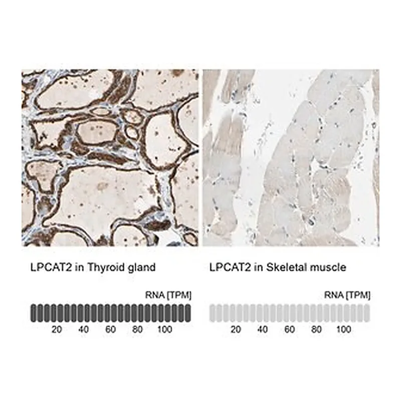 Merck Anti-LPCAT2 antibody produced in rabbit