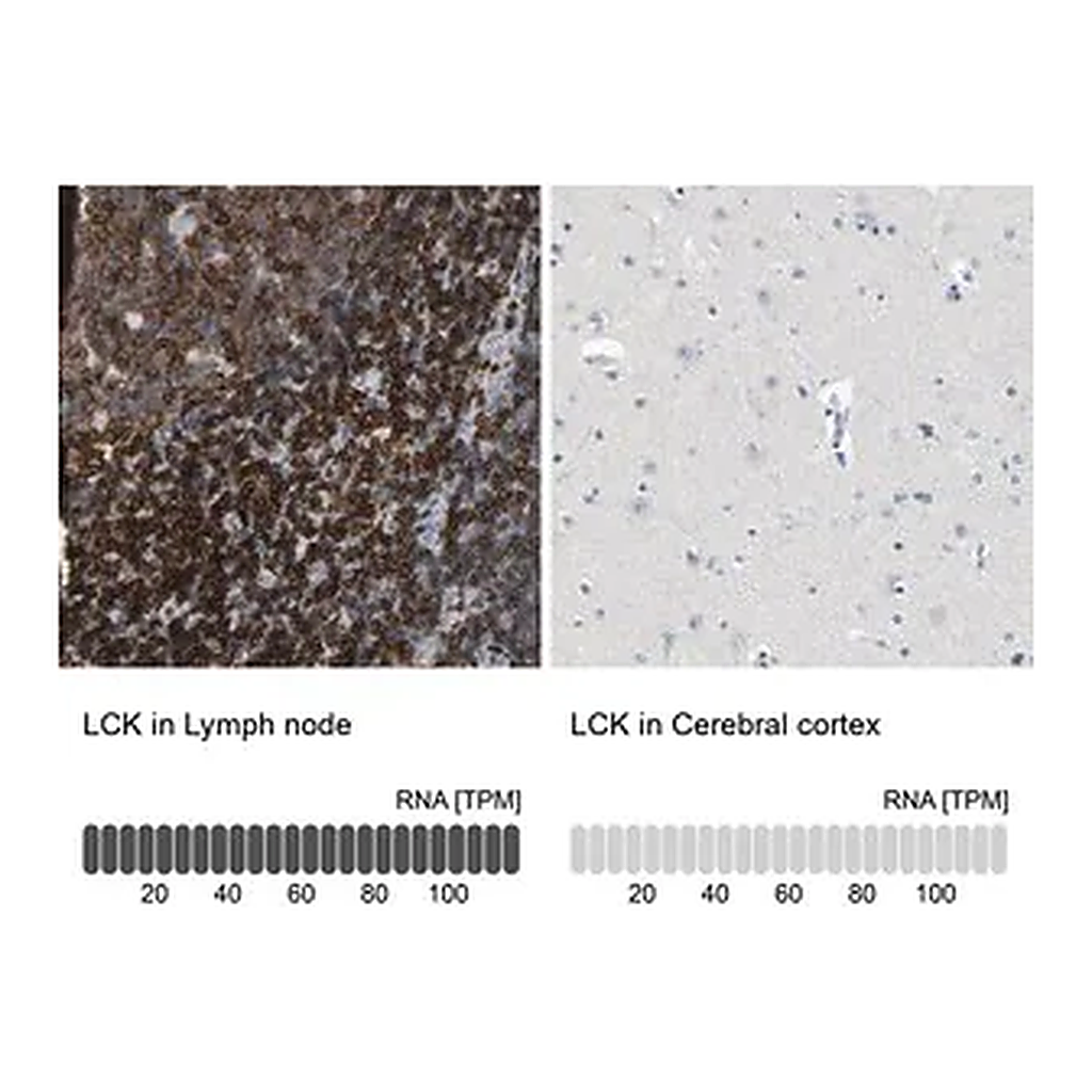 Merck Anti-LCK antibody produced in rabbit