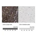 Merck Anti-LCK antibody produced in rabbit