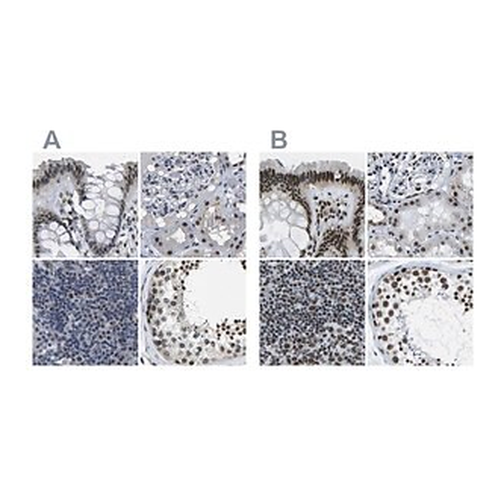 Merck Anti-NSRP1 antibody produced in rabbit