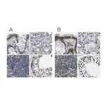 Merck Anti-NSRP1 antibody produced in rabbit