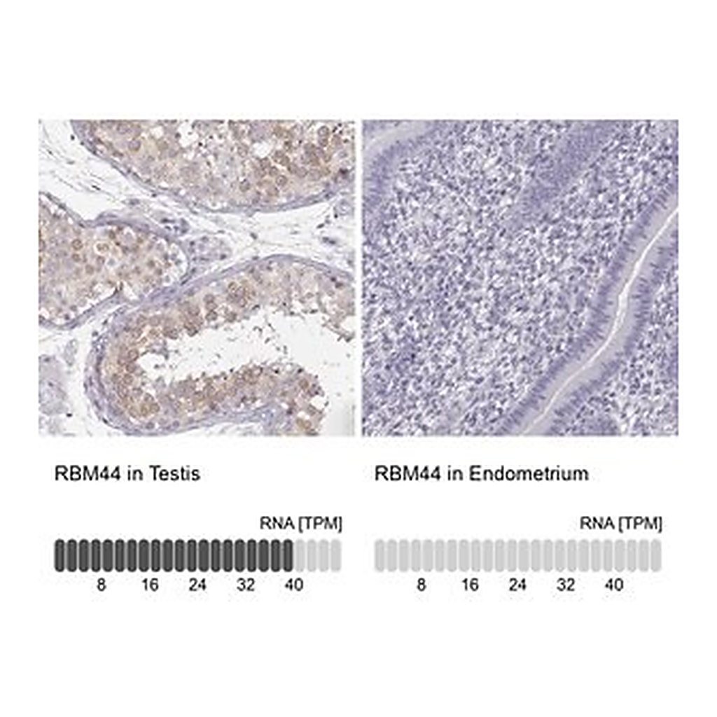 Merck Anti-RBM44 antibody produced in rabbit