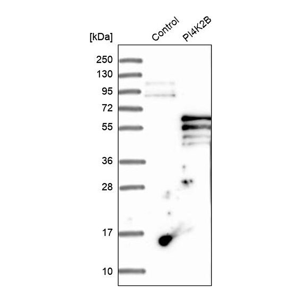 Merck Anti-PI4K2B antibody produced in rabbit