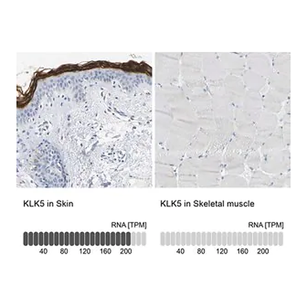 Merck Anti-KLK5 antibody produced in rabbit