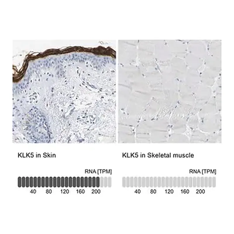 Merck Anti-KLK5 antibody produced in rabbit