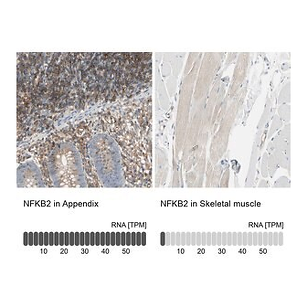 Merck Anti-NFKB2 antibody produced in rabbit
