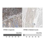 Merck Anti-NFKB2 antibody produced in rabbit