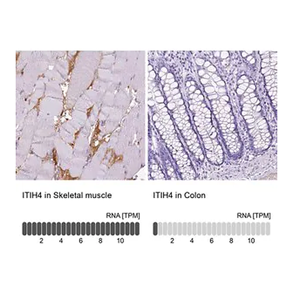 Merck Anti-ITIH4 antibody produced in rabbit