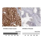 Merck Anti-MYOM2 antibody produced in rabbit