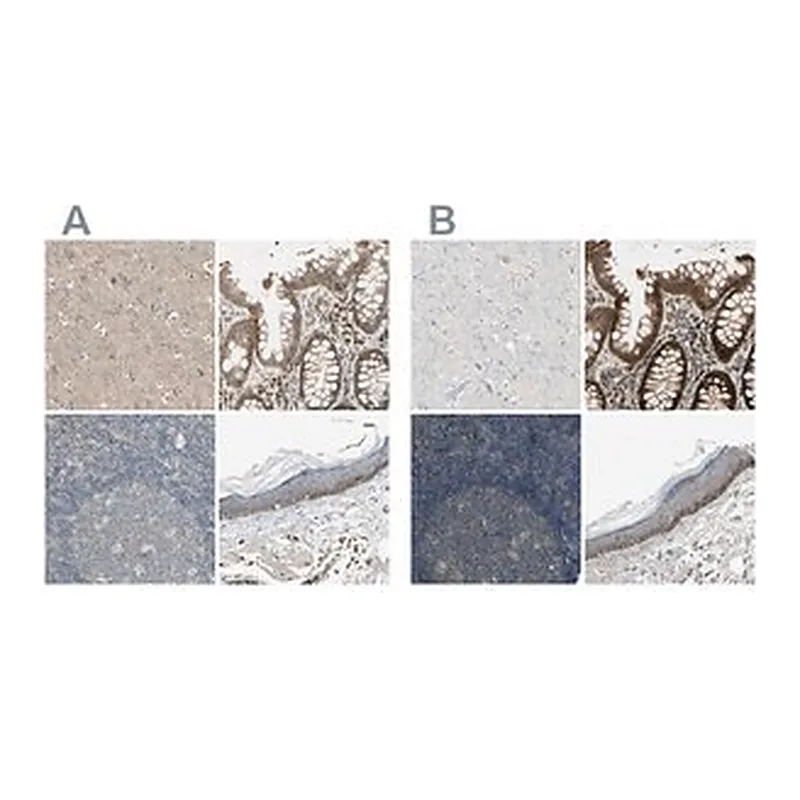 Merck Anti-MST1R antibody produced in rabbit