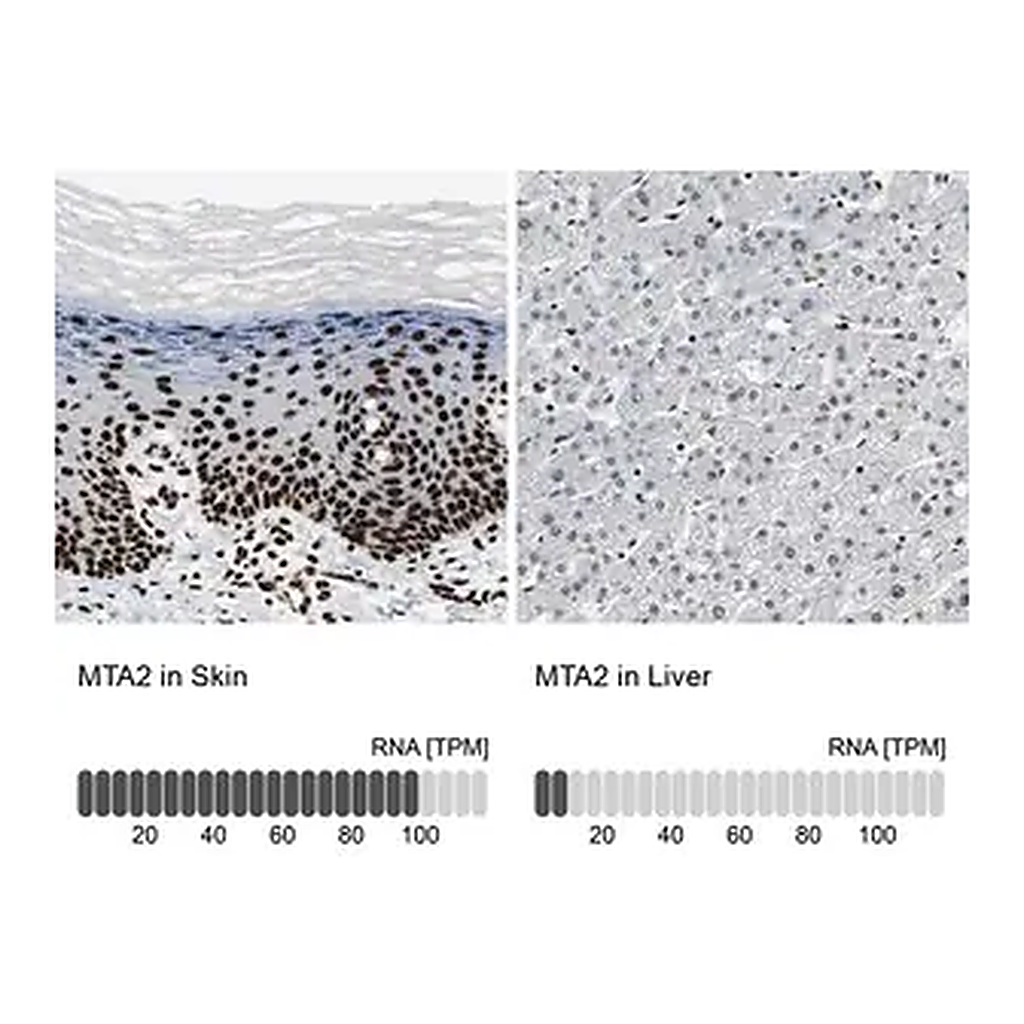 Merck Anti-MTA2 antibody produced in rabbit