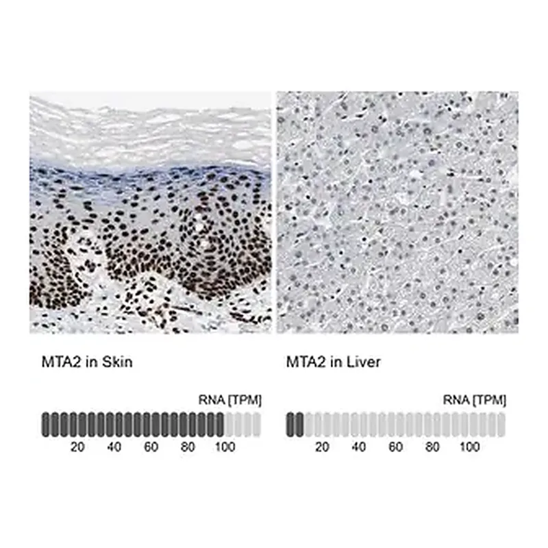 Merck Anti-MTA2 antibody produced in rabbit