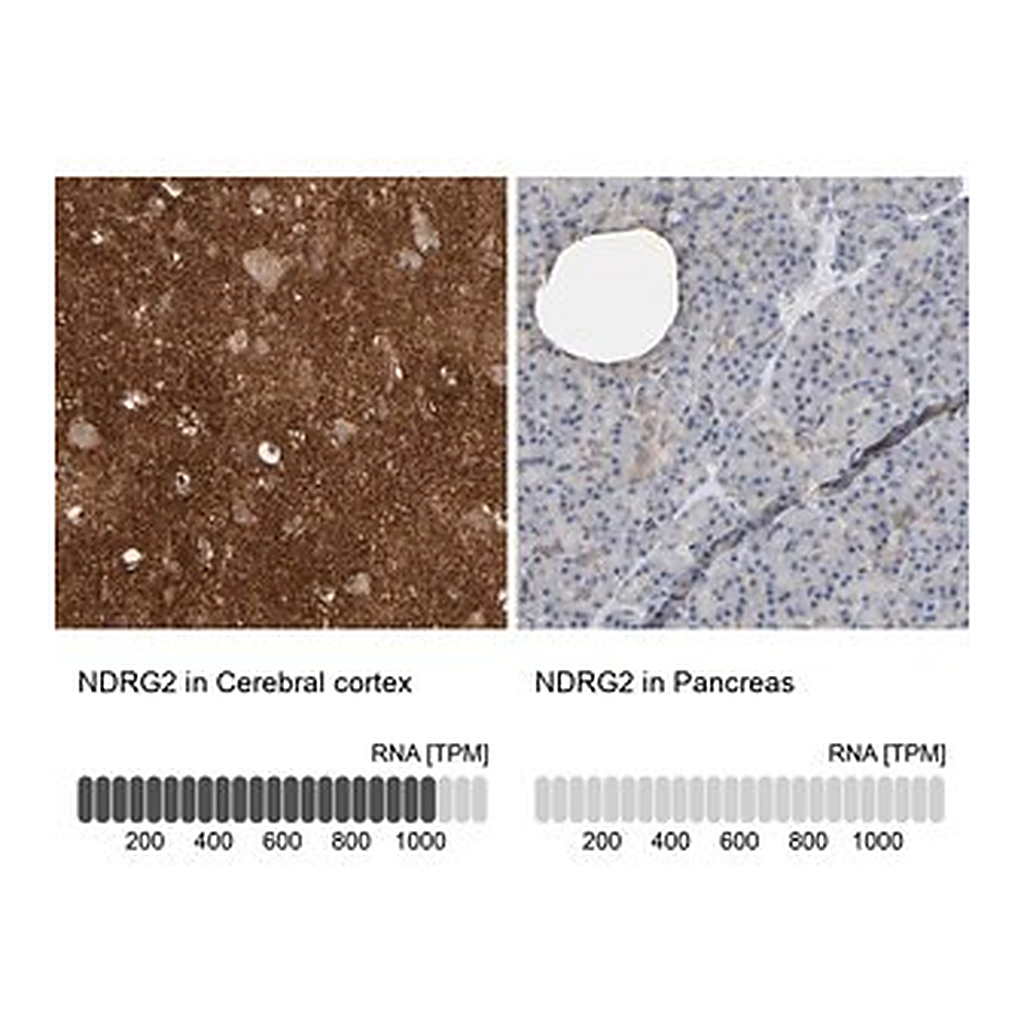 Merck Anti-NDRG2 antibody produced in rabbit