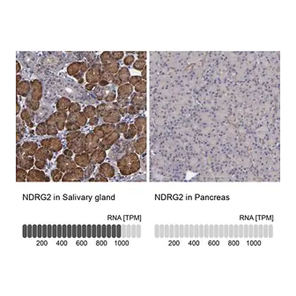 Merck Anti-NDRG2 antibody produced in rabbit