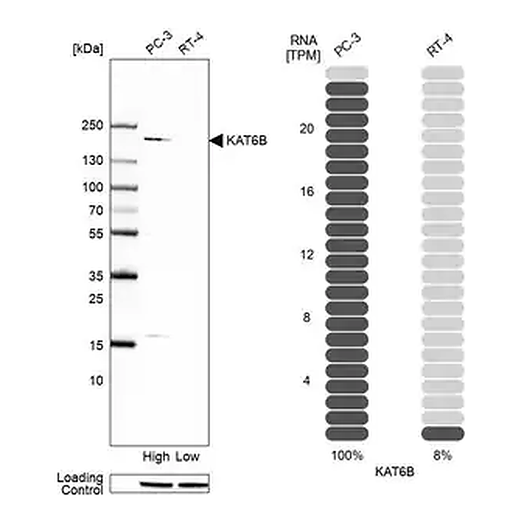 Merck Anti-KAT6B antibody produced in rabbit