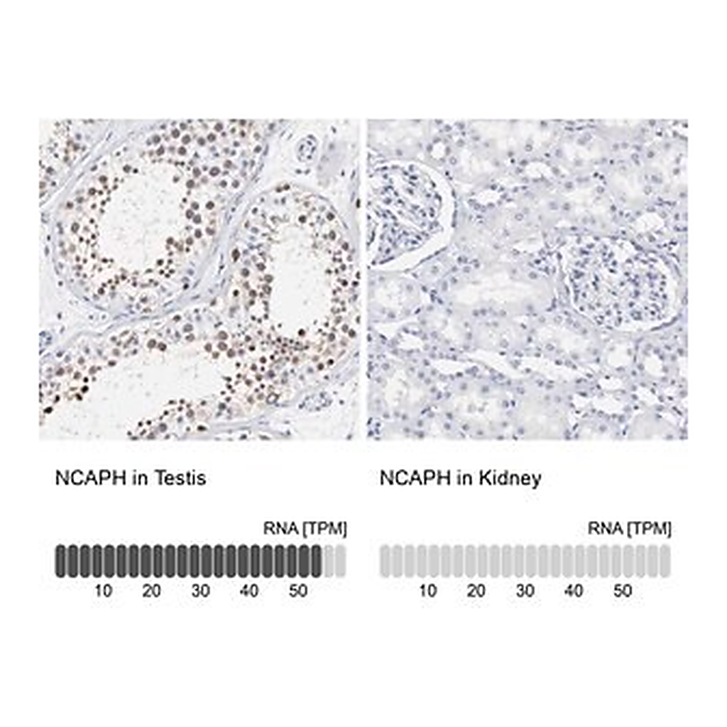 Merck Anti-NCAPH antibody produced in rabbit