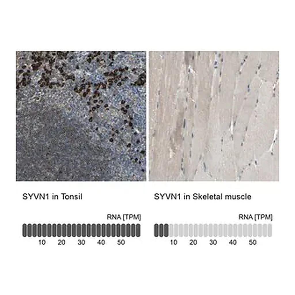 Merck Anti-SYVN1 antibody produced in rabbit