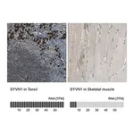Merck Anti-SYVN1 antibody produced in rabbit