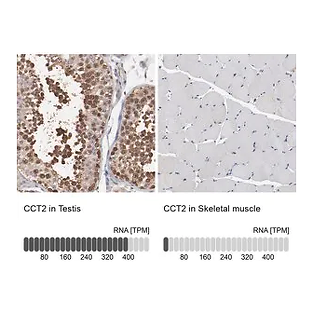 Merck Anti-CCT2 antibody produced in rabbit