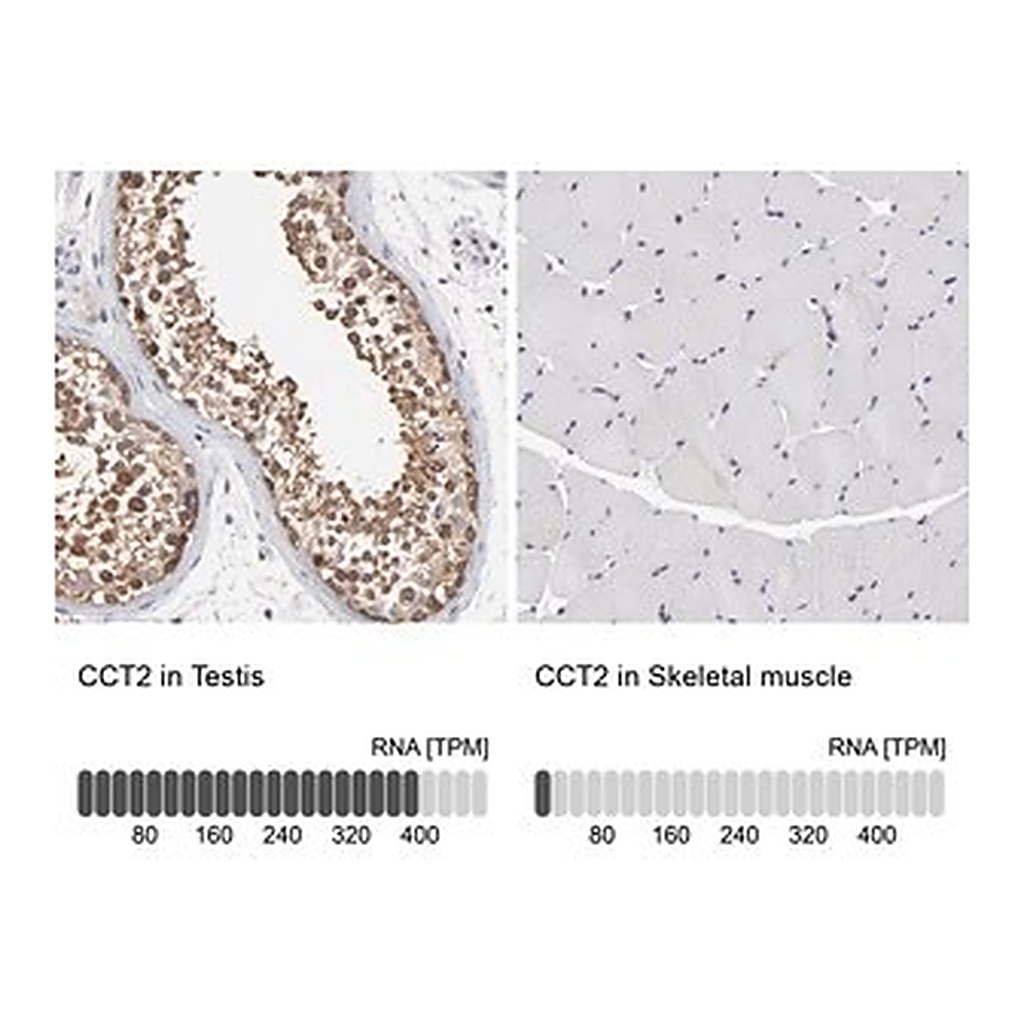 Merck Anti-CCT2 antibody produced in rabbit