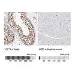 Merck Anti-CCT2 antibody produced in rabbit