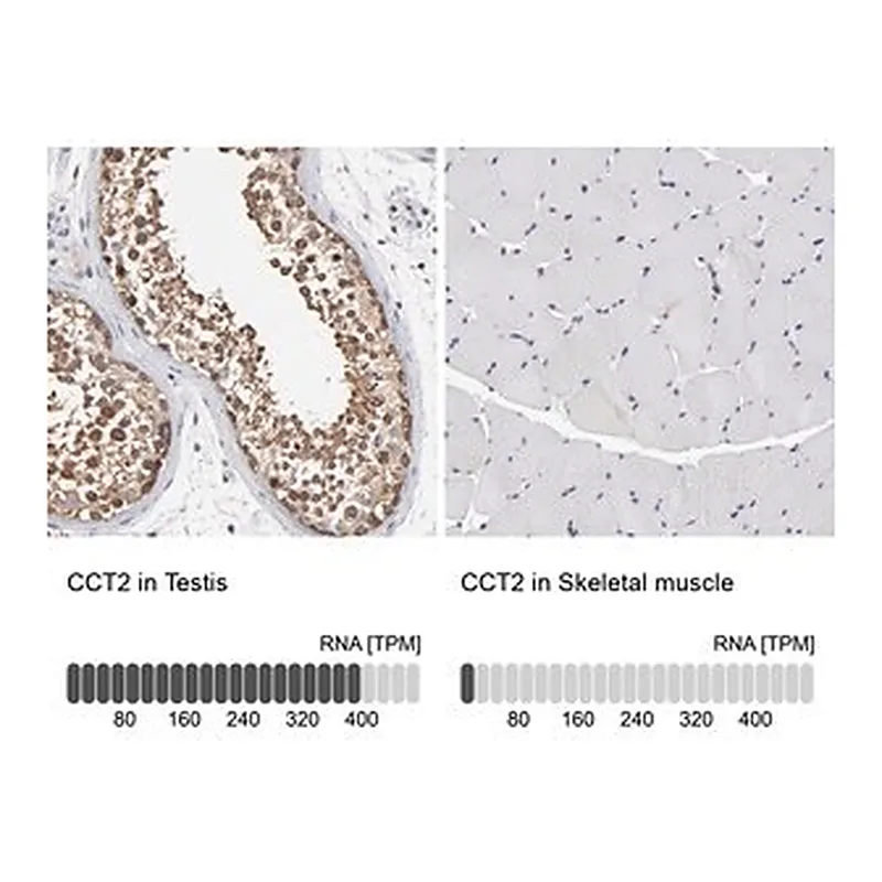 Merck Anti-CCT2 antibody produced in rabbit