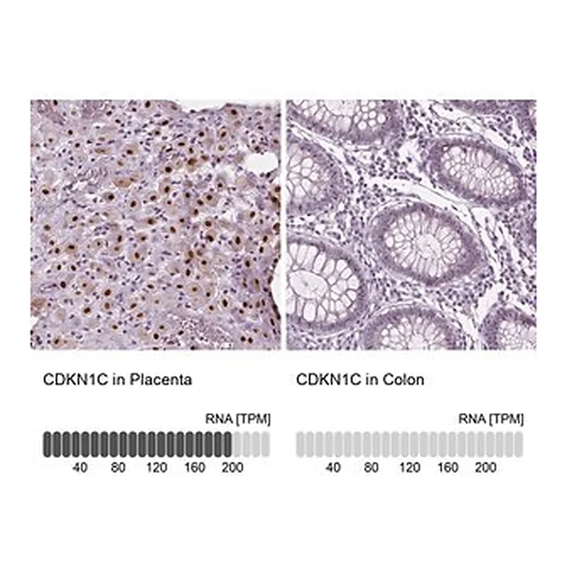 Merck Anti-CDKN1C antibody produced in rabbit
