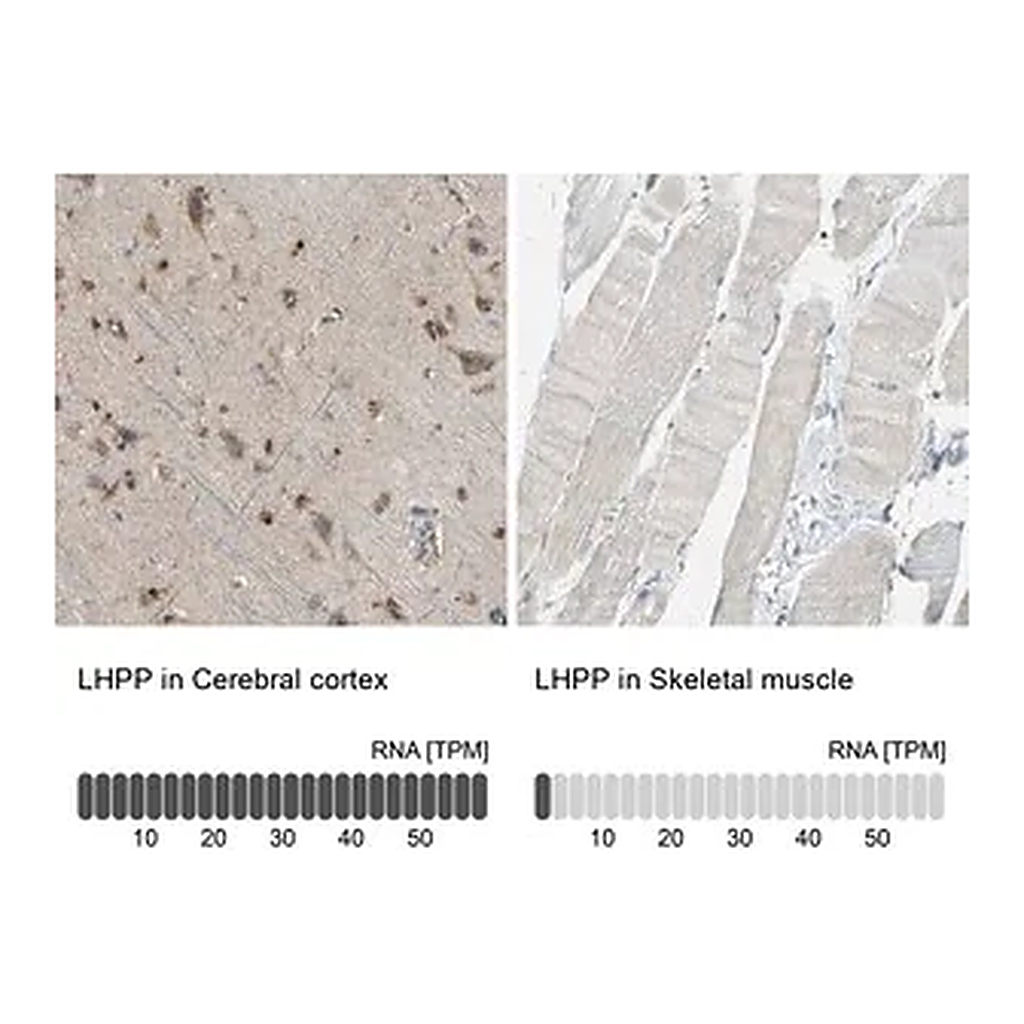 Merck Anti-LHPP antibody produced in rabbit