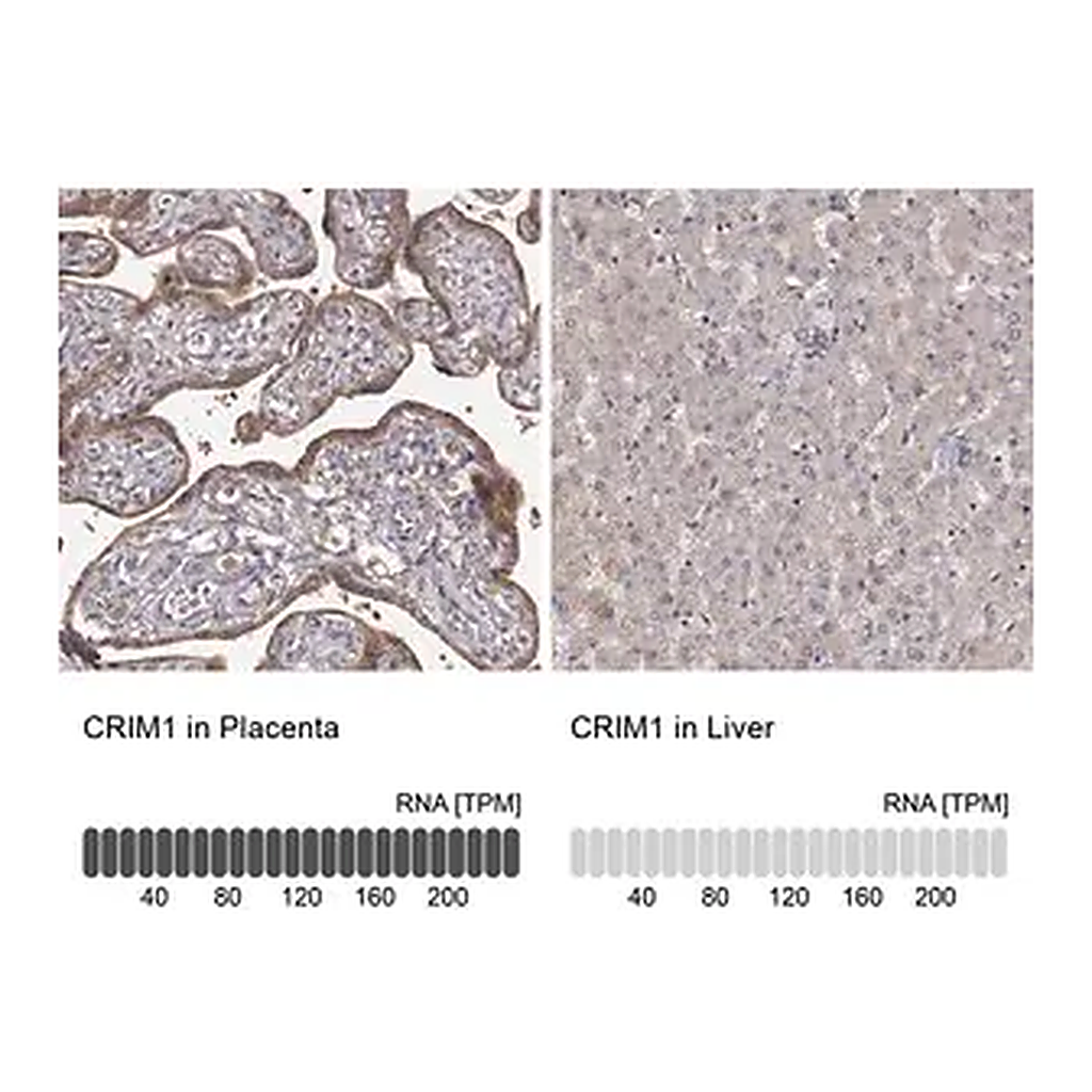 Merck Anti-CRIM1 antibody produced in rabbit