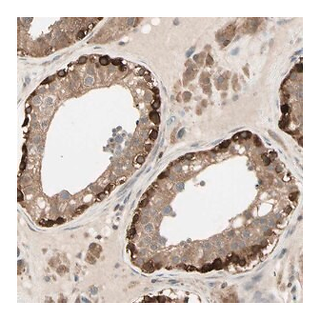 Merck Anti-OXSR1 antibody produced in rabbit