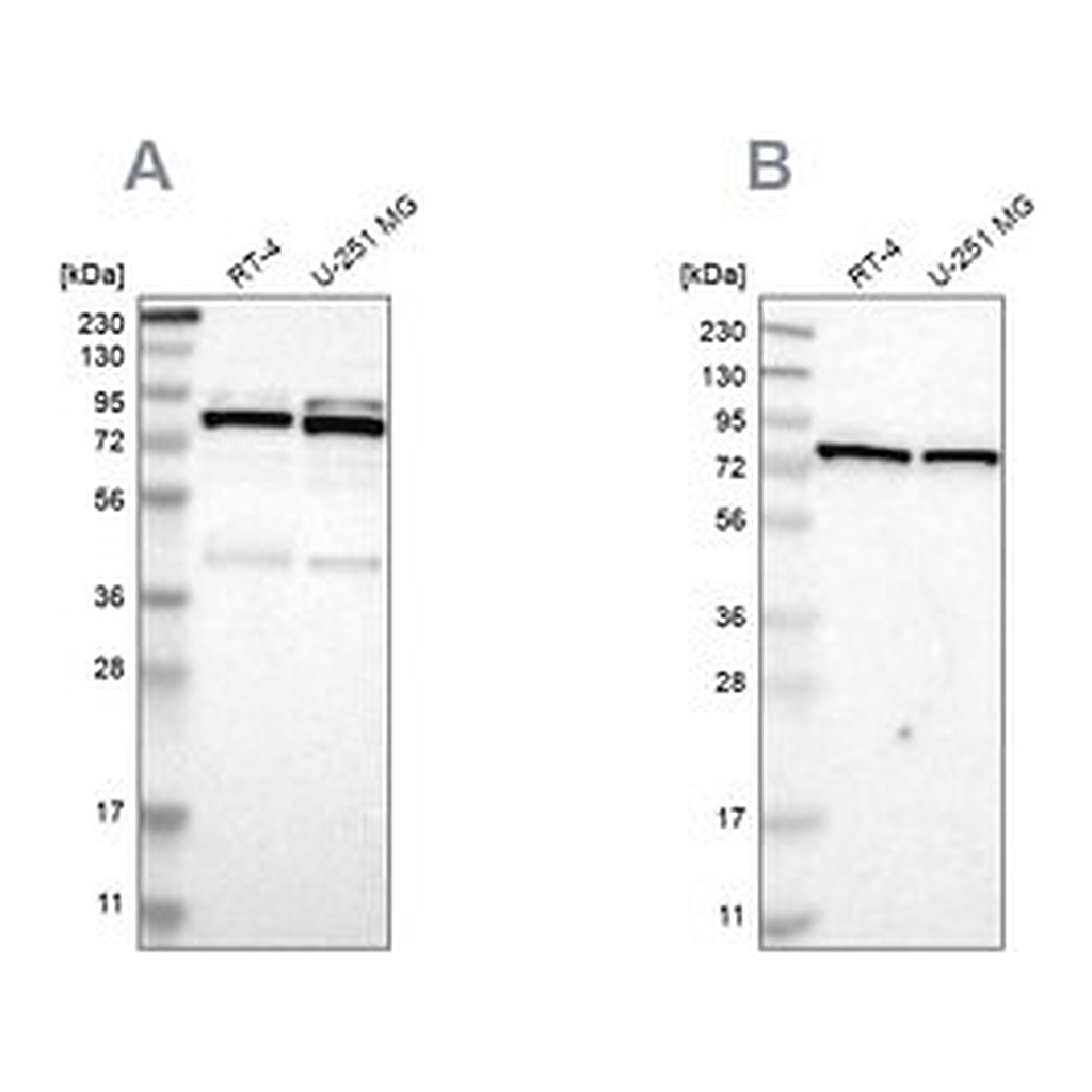 Merck Anti-PARN antibody produced in rabbit