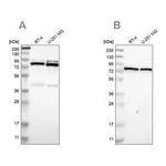 Merck Anti-PARN antibody produced in rabbit