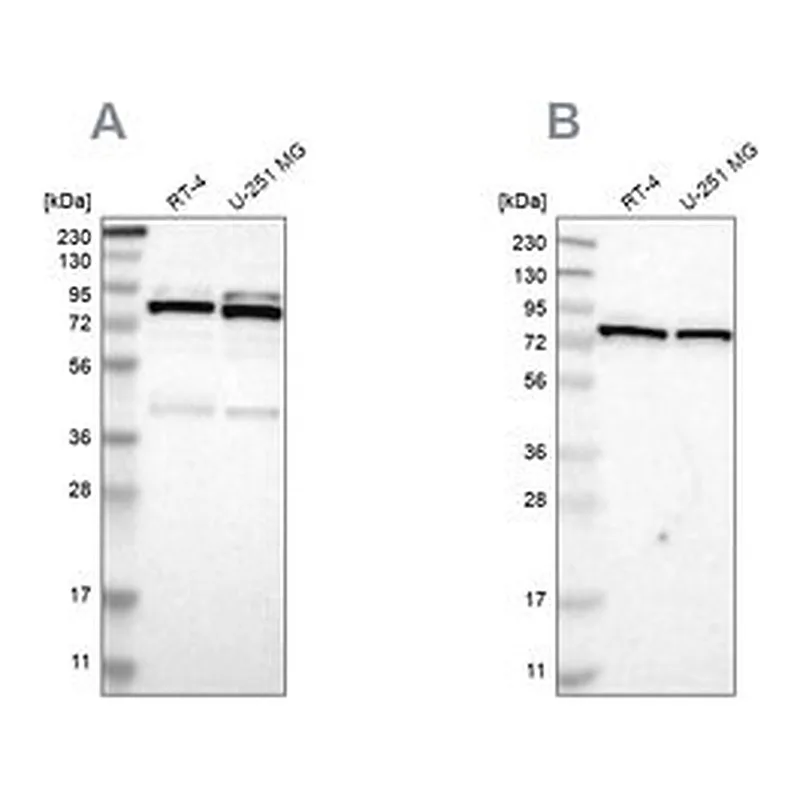 Merck Anti-PARN antibody produced in rabbit