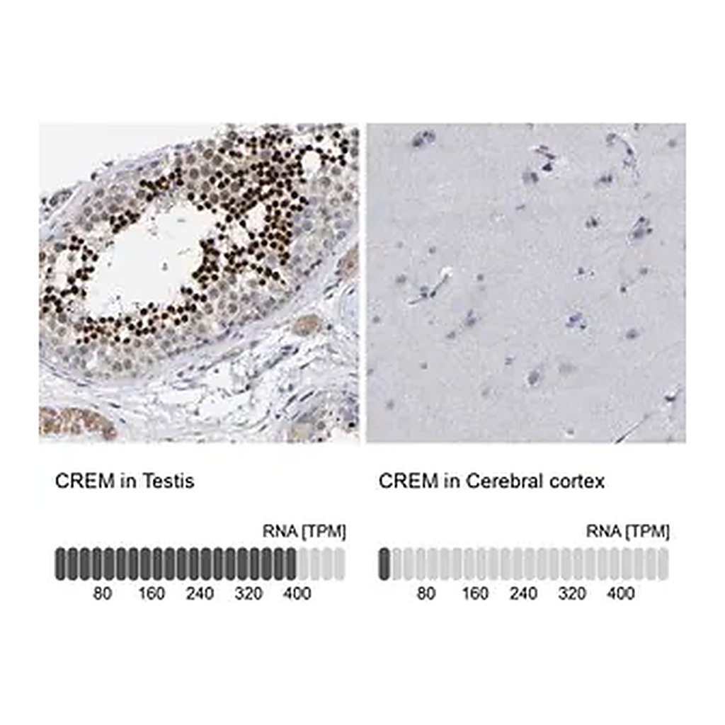 Merck Anti-CREM antibody produced in rabbit