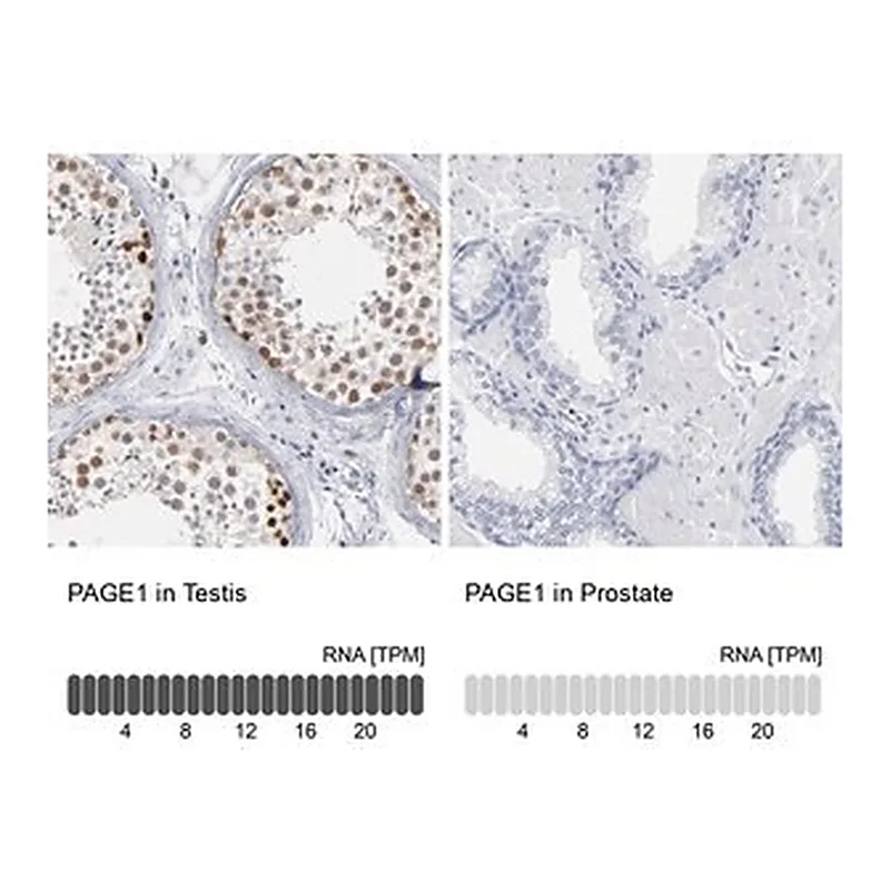 Merck Anti-PAGE1 antibody produced in rabbit