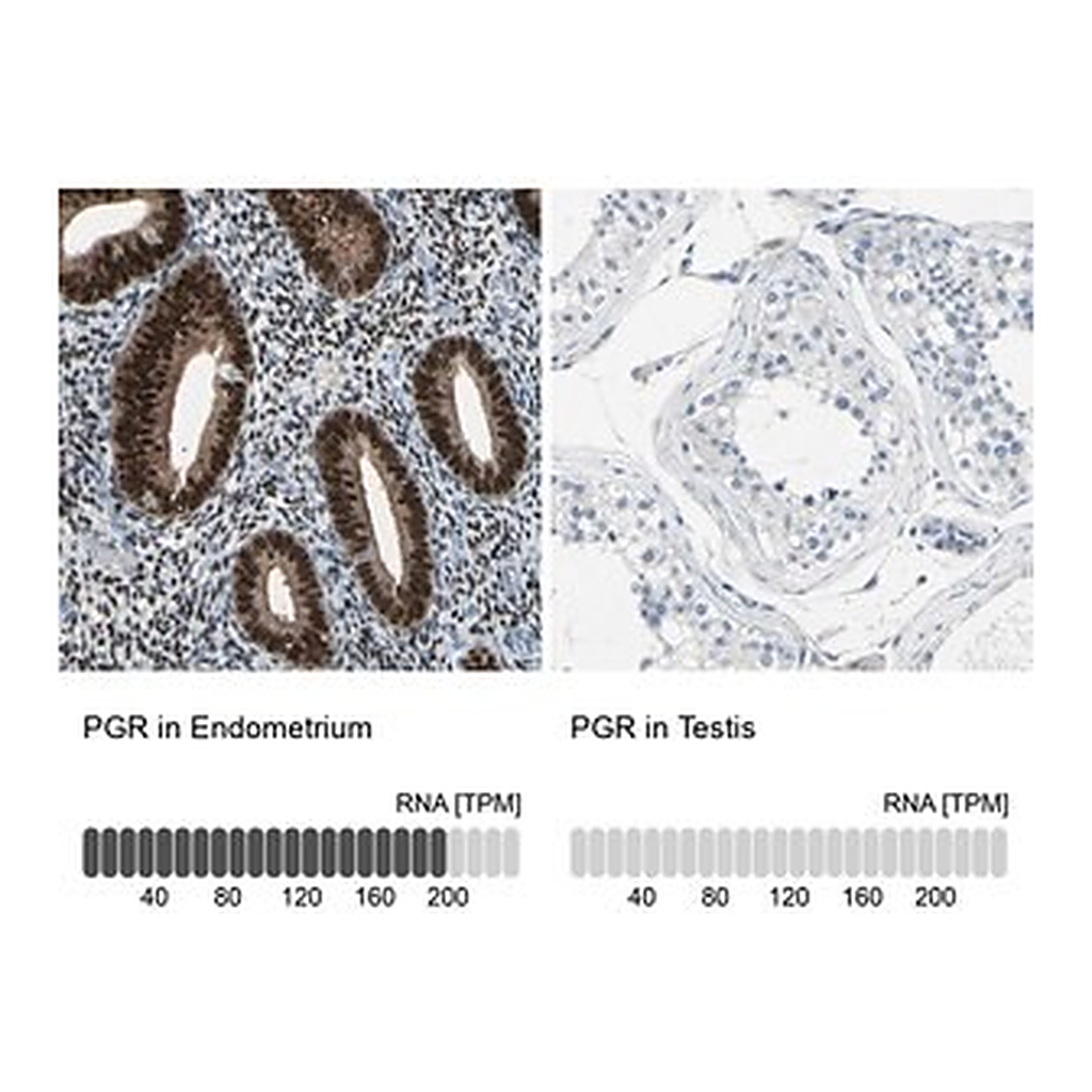 Merck Anti-PGR antibody produced in rabbit