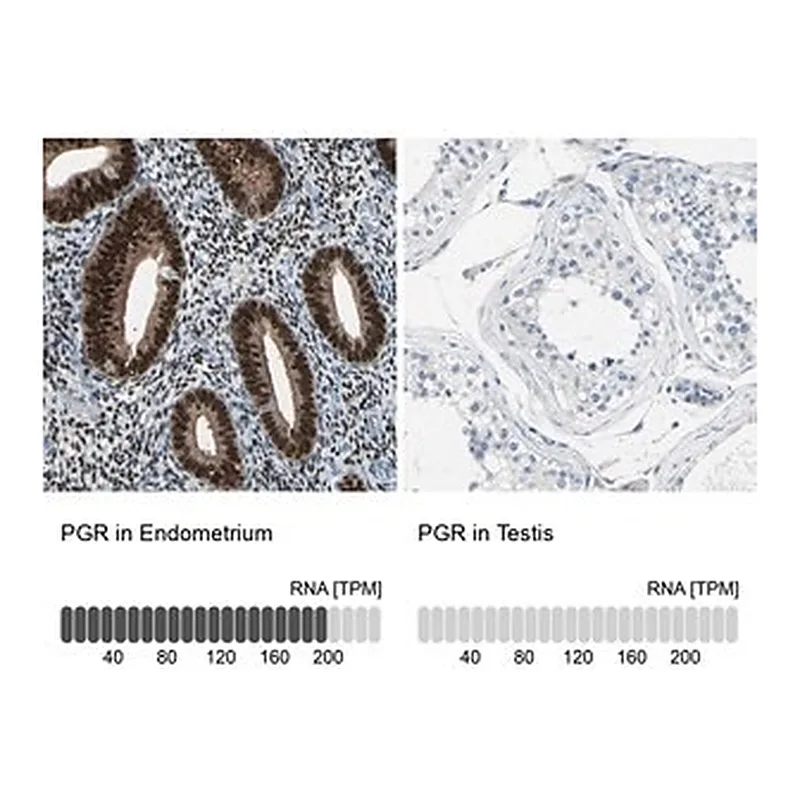 Merck Anti-PGR antibody produced in rabbit
