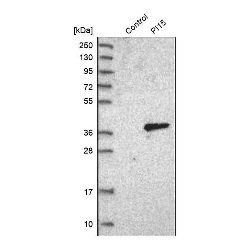 Merck Anti-PI15 antibody produced in rabbit